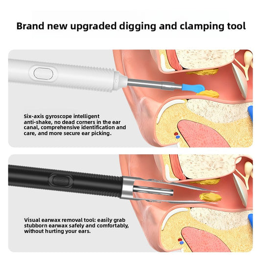 Professional Ear Cleaning Kit for Safe Ear Care