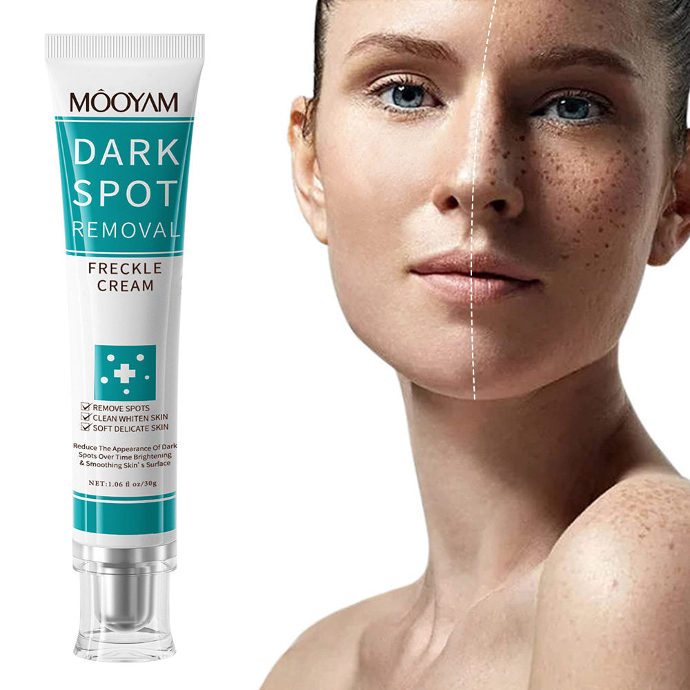 Dark spot removal face cream