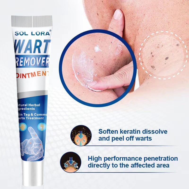 Anti-Wart Ointment | Fast-Acting Skin Care Solution UK - Wart Removers | Buy Online in UK