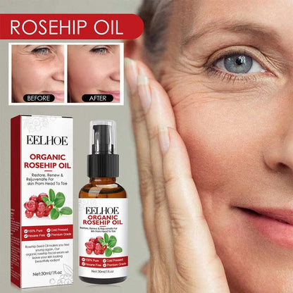 EELHOE Rosehip Serum-0
